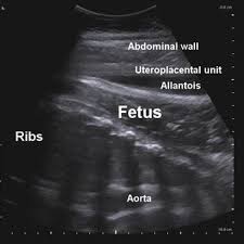 The heart rate can vary according to the body's physical needs, including the need to absorb oxygen and excrete carbon dioxide. Pdf Transabdominal Ultrasonographic Evaluation Of Fetal Well Being In The Late Term Mare And Cow