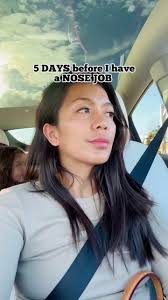 Jeraldine Blackman Nose Job Revelation Post-Surgery Update