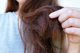 Hair loss prevention and treatment may involve minoxidil (rogaine) or finasteride (propecia). How To Prevent Hair Loss For Women Inspirationfeed