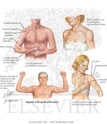 Image result for Shoulder Exam