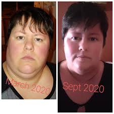 weight loss progress after bariatric surgery