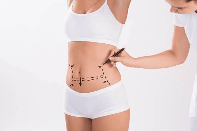 tummy tuck Archives | Centurion Day Hospital