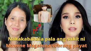 6, some instagram users wondered about her diet and alleged that she had anorexia or bulimia. Maxene Magalona Sobrang Payat Dahil Sa Sakit Niya Youtube