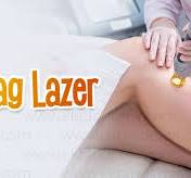 ND:Yag Lazer - Nd:YAG Lazer Epilasyon - Dermatolog Dr. Ektan ...