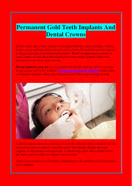 Dentistry is one of the few nhs services where you have to pay a contribution towards the cost of your care. Permanent Gold Teeth Implants And Dental Crowns