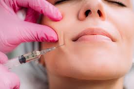 Types of Dermal Fillers