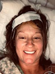 Today marks EXACTLY 5 years since my brain surgery! Thank you, Dr. Bogaev!