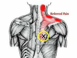 Pin On Shoulder Injuries Rehabilitation