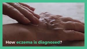 It's being said that few epsom salt sprays including , warm water and essential oils can offer a relaxing and calming effect on your body. What Bath Salts Or Dead Sea Salt Calms Eczema Dead Sea Minerals Cosmetics
