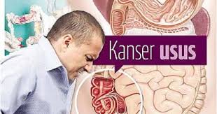 Skor gleason dan paras psa adalah lebih rendah dan berkemungkinan juga tiada sebarang simptom akan kelihatan pada masa ini. Wajib Tahu Inilah Dia Tanda Tanda Kanser Usus Tahap 3 Ketahuinya Sebelum Terlambat Lidah Bisa