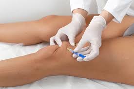 Hyaluronsaure Ins Knie Sinn Und Zweck Der Injektion
