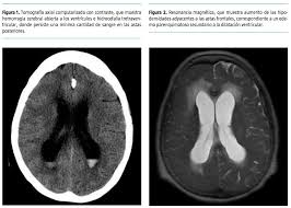 We did not find results for: Psicosis Organica De Tipo Esquizofreniforme Psiquiatras Castellon Rebeca Ros Mentalsalud