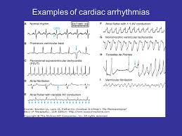 Drugs Used To Treat Cardiac Arrhythmias Ppt Video Online