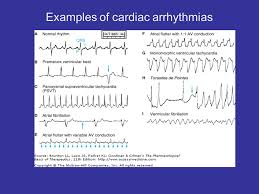 drugs used to treat cardiac arrhythmias ppt video online