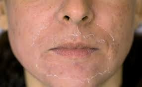 We did not find results for: Beauty Journal Situs Kecantikan Dan Gaya Hidup Andalan Wanita Masa Kini