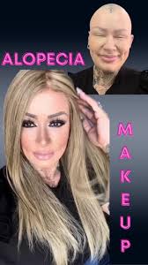 Repost from @michemoffatt • ALOPECIA MAKEUP & WHEELCHAIR OUTFIT- another  wee video! 🖤 This was a super quick 12 minute makeup, just cut down to a  minute! At the moment, I do feel better wearing a wig ...