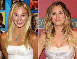 #thebigbangtheory as penny @bricuoco retweetd us 1. Kaley Cuoco Asi Lucia Kaley Cuoco Antes De Sus Operaciones Moda Y Belleza Los40 Mexico