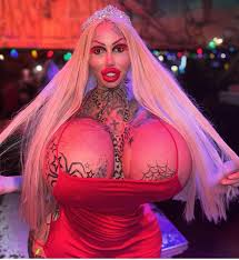 I just want to live a normal life now - Instagram Model Mary Magdalene  whose Breast Implant