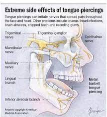 Extreme Side Effects Of Tongue Piercing Dental Pediatric Dentistry Dentistry