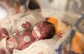 All babies are unique and meet milestones at their own pace. What To Expect From A Baby Born At 29 Weeks Lovetoknow