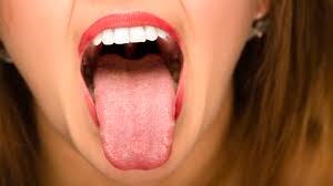 5 cuidados que você deve ter com a higiene da língua | Sorridents ...
