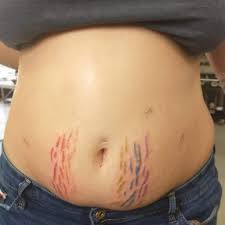 We did not find results for: Can Tattoos Cover Stretch Marks Everything You Need To Know Saved Tattoo