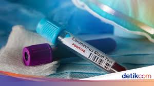 Jaga jarak minimal 1 meter dari orang lain, dan jangan dulu ke luar rumah kecuali ada keperluan mendesak. Gejala Dan Ciri Ciri Virus Corona Pada Bayi Dan Anak Wajib Waspada