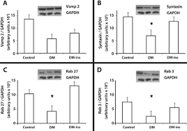 Jun 04, 2021 · odair braz jr. Scielo Brasil Insulin Replacement Restores The Vesicular Secretory Apparatus In The Diabetic Rat Lacrimal Gland Insulin Replacement Restores The Vesicular Secretory Apparatus In The Diabetic Rat Lacrimal Gland