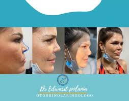 ▪Dr. Edward Polanía