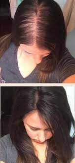Dark Brown Hair Toppers For Women With Thinning Hair Or Hair Loss How To Get Instant Vol Thick Hair Styles Thin Hair Styles For Women Extensions For Thin Hair