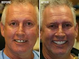 We did not find results for: Dentures Crane Mo Denture Dentist Crane Missouri