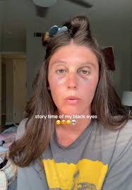 People with Black Eyes Stories Monique
