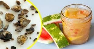 This Watermelon Rind Juice Can Break Down Kidney Stones And Stop Urinary Tract Infection Watermelon Benefits Healthy Work Health Disease