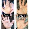 This study reports a systematic review of the epidemiology of hfmd in asia. 1