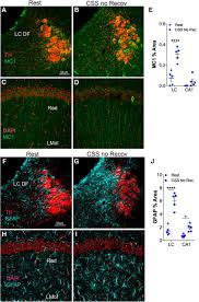 Chronic Sleep Disruption Advances the Temporal Progression of Tauopathy in  P301S Mutant Mice