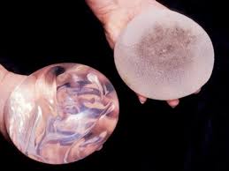 How much is a breast implant cost. Breast Implants Types Costs Procedures Complications And Recovery