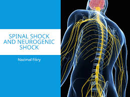 Image result for Spinal Shock
