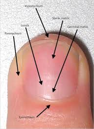 Image result for paronychium