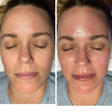 Cindy Rieger, Aesthetician- Professional, Licensed, Skincare