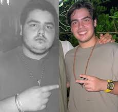 Clique na seta â direita para ver o antes do resgate. Um Ano Apos Cirurgia Bariatrica Filho De Faustao Aparece 50 Quilos Mais Magro Compare Estrelando