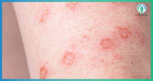 Somjai april 25, 2017 at 6:44 a à¸‹ à¸¡ à¸² à¸ª à¸‡à¸„ à¸‡ à¸—à¸³à¹„à¸¡à¸• à¸­à¸‡à¹€à¸› à¸™à¸•à¸­à¸™à¸§ à¸¢à¸£ à¸™ à¸œ à¸Šà¸²à¸¢à¸ª à¸§à¸™à¹ƒà¸«à¸ à¹€à¸„à¸¢à¹€à¸› à¸™à¸ˆà¸£ à¸‡à¸¡ à¸¢