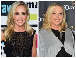Oct 15, 2020 · speaking to us magazine, shannon recently admitting that she was not surprised to hear lesley, 36, was expecting their first child, adding: Real Housewives Of Orange County Star Shannon Beador Sparks Plastic Surgery Rumors See Her Transformation