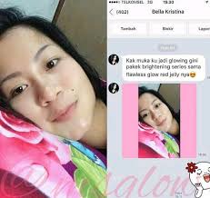 Toner glow, toner klink, dan toner acne. Berapa Hari Pakai Ms Glow Wajah Bersih