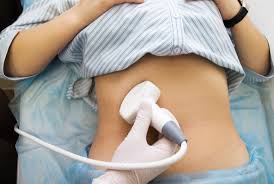 Almost all health plans cover at least one ultrasound during a woman's pregnancy. Abdominal Ultrasounds Scan Everything You Need To Know