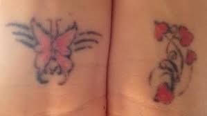 The sole purpose of this machine is to remove ink particles and/or pigmentation from the skin. Laser Tattoo Removal Align Clinics