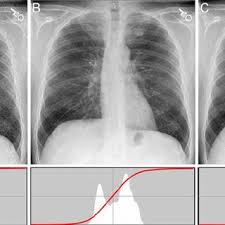 Pdf The Standardized Exposure Index For Digital Radiography An Opportunity For Optimization Of Radiation Dose To The Pediatric Population