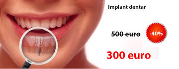 250 eur euro to ngn nigerian naira. Oferta Implant Dentar Premium Pret 400 De Euro Bont Protetic Inclus Consultatie Gratuita