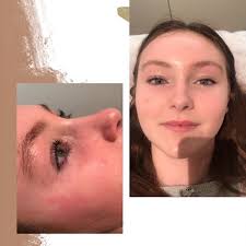 Advanced Beauty Concepts Medispa