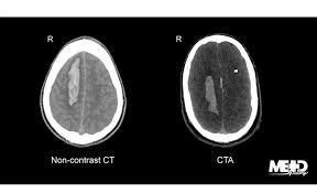 Image result for CT Head