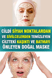 Cildi Siyah Noktalardan Ve Sivilcelerden Temizleyen Ciltteki Kasinti Ve Batmayi Onleyen Dogal Maske Siyah Noktalar Cil Dogal